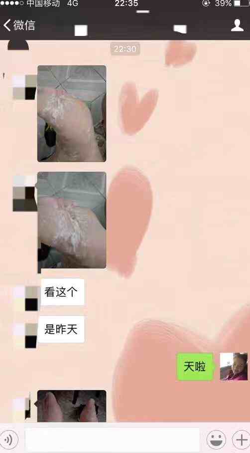 ϴʼ˽ܲЧ_Ǯ