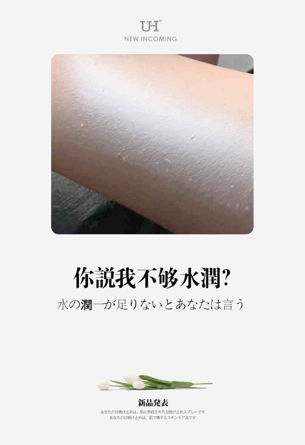 \