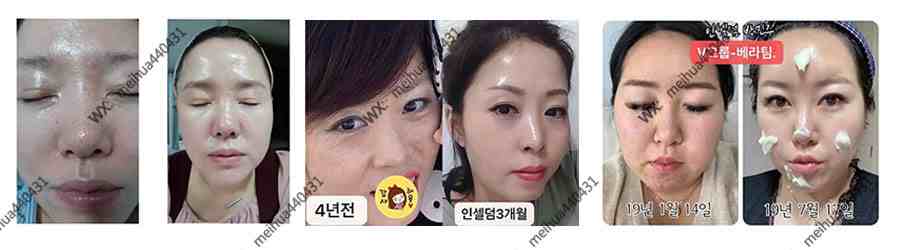 bna2_워터마크.jpg